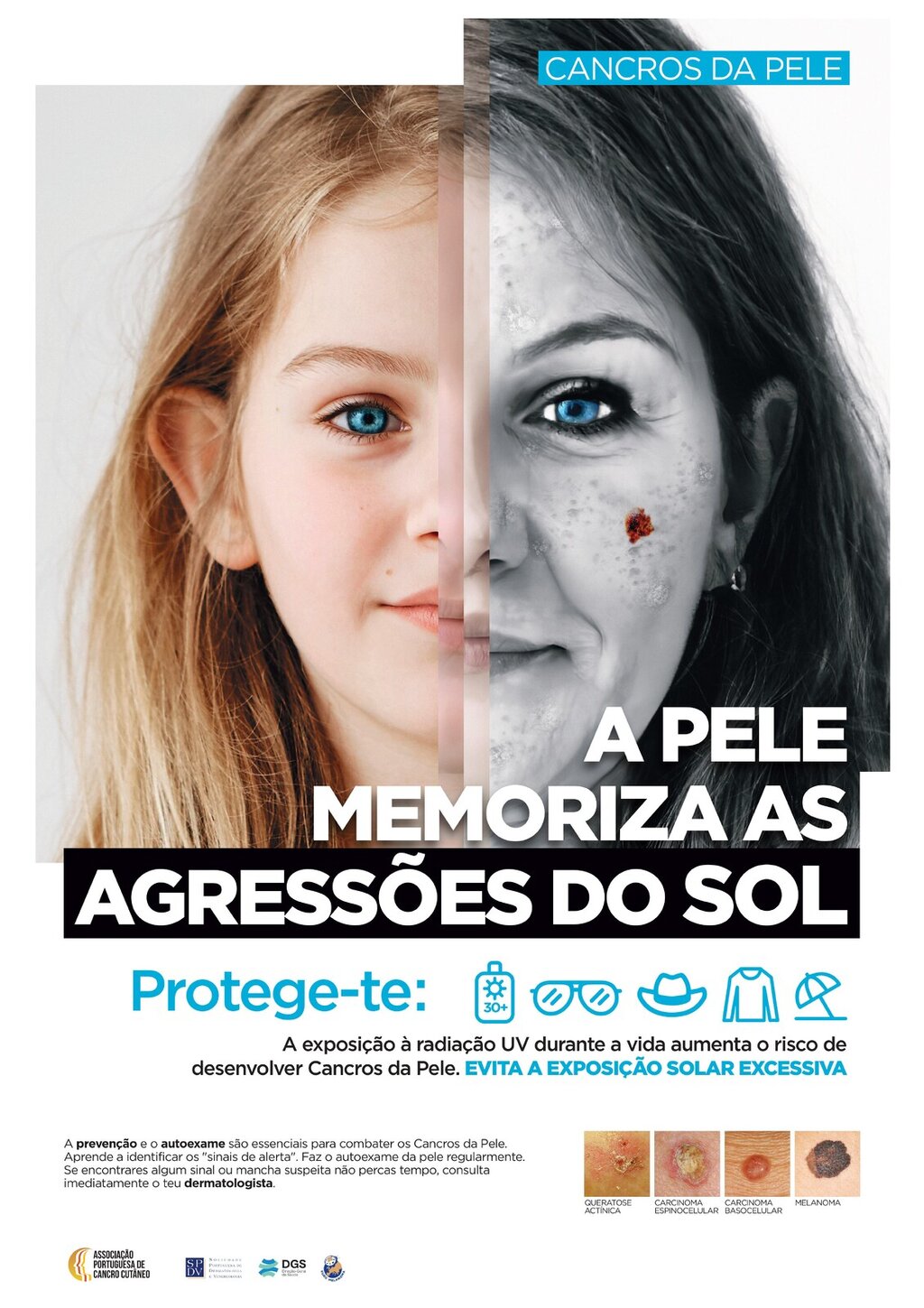 Campanha "Pele e SOL 2025" - Associação Portuguesa de Cancro Cutâneo